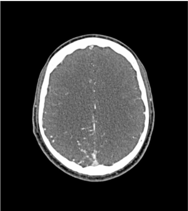 Anatomy Phantom Models for CT,  X-Ray, and Radiation Therapy