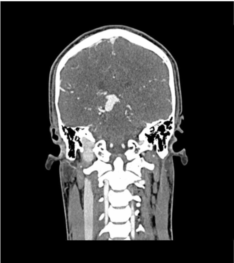 Anatomy Phantom Models for CT,  X-Ray, and Radiation Therapy