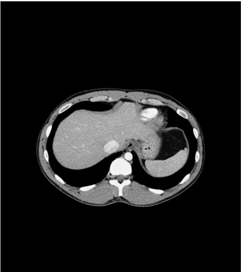 Anatomy Phantom Models for CT,  X-Ray, and Radiation Therapy
