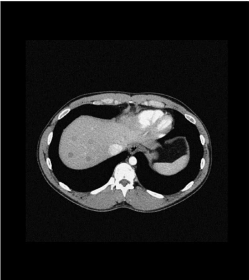Anatomy Phantom Models for CT,  X-Ray, and Radiation Therapy