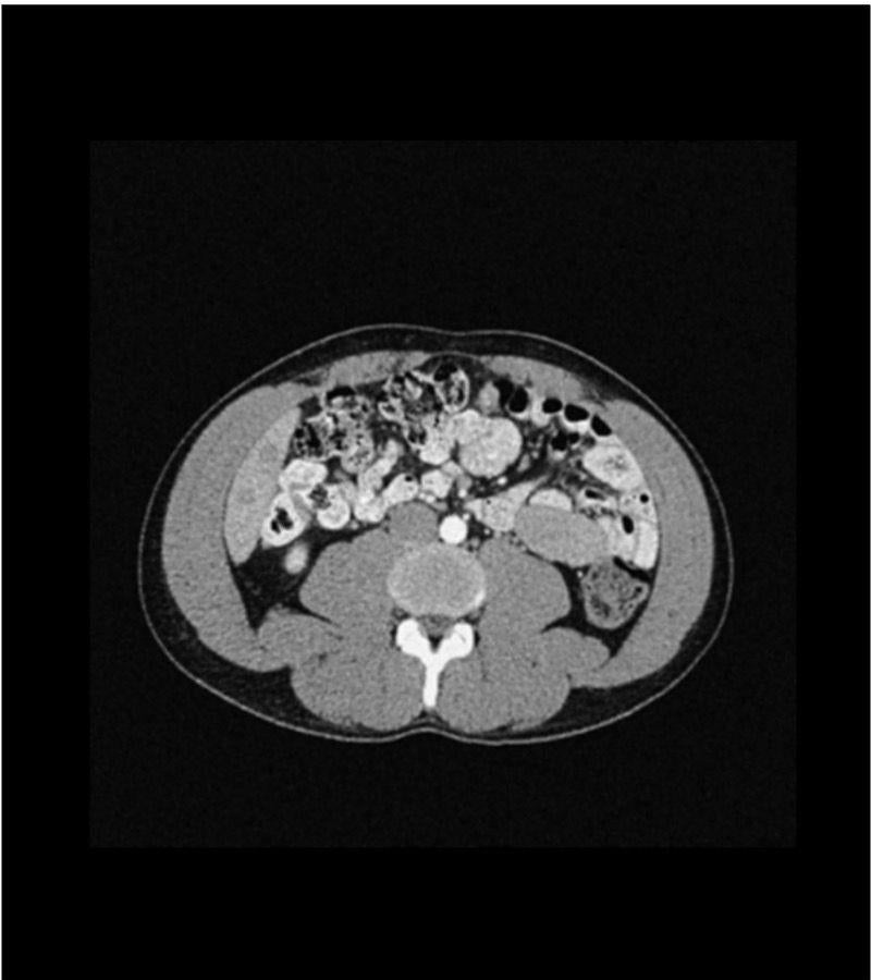 Anatomy Phantom Models for CT,  X-Ray, and Radiation Therapy
