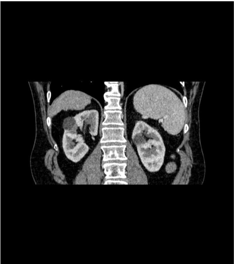 Anatomy Phantom Models for CT,  X-Ray, and Radiation Therapy