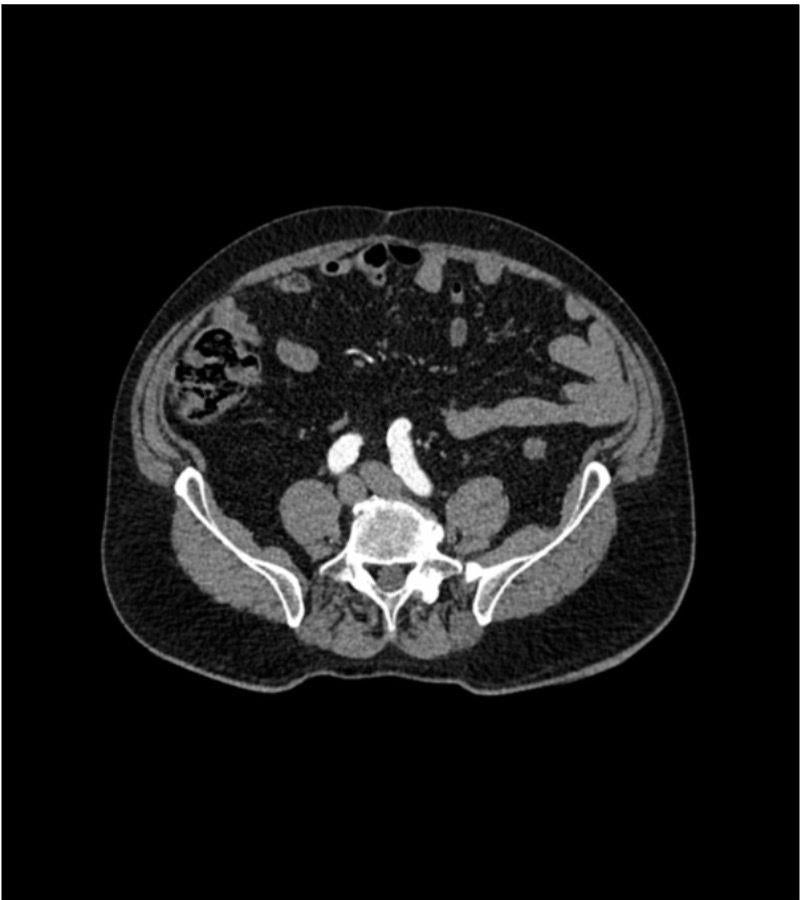 Anatomy Phantom Models for CT,  X-Ray, and Radiation Therapy