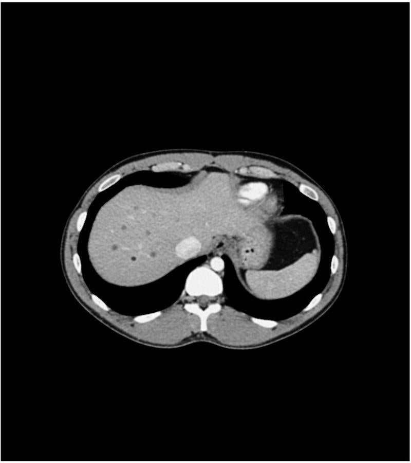 Anatomy Phantom Models for CT,  X-Ray, and Radiation Therapy