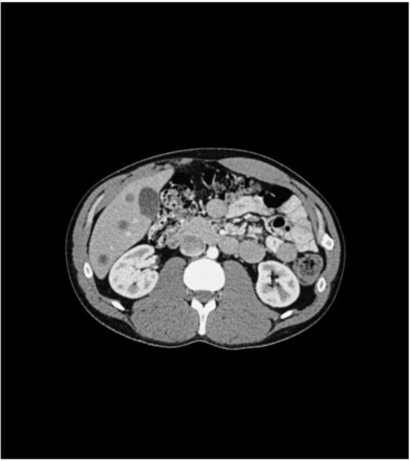 Anatomy Phantom Models for CT,  X-Ray, and Radiation Therapy