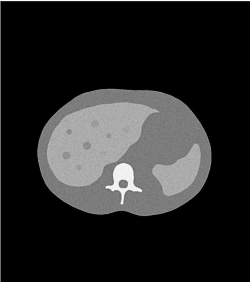 Anatomy Phantom Models for CT,  X-Ray, and Radiation Therapy