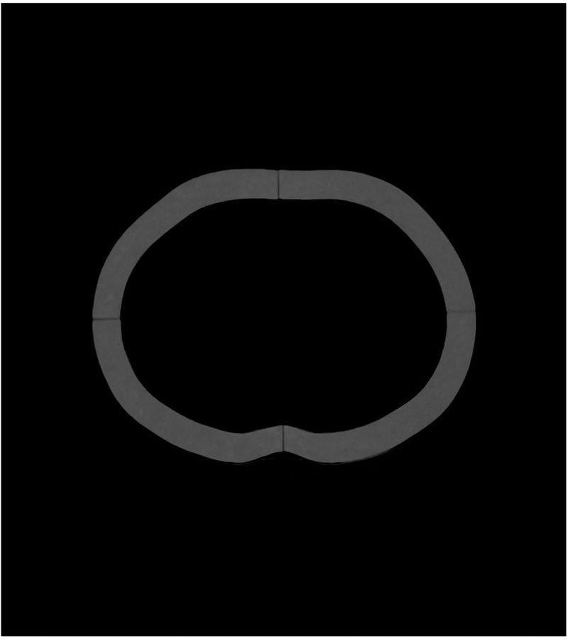 Fat Rings for Abdomen Phantom
