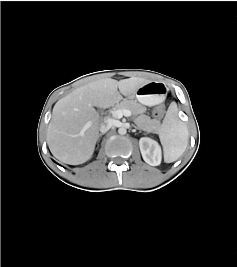 Anatomy Phantom Models for CT,  X-Ray, and Radiation Therapy
