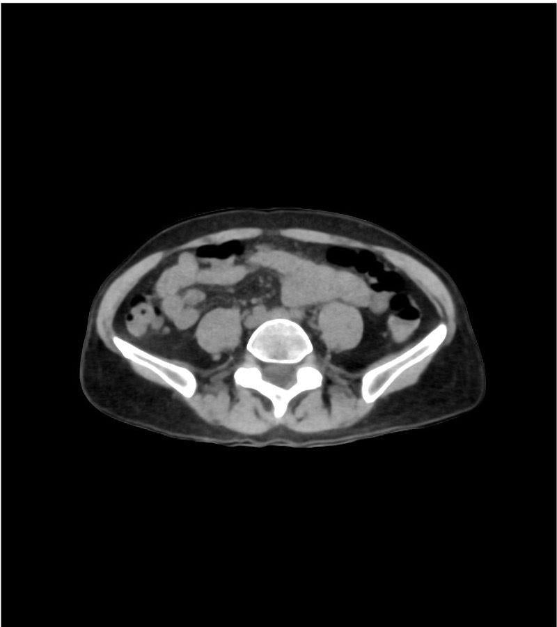 Anatomy Phantom Models for CT,  X-Ray, and Radiation Therapy