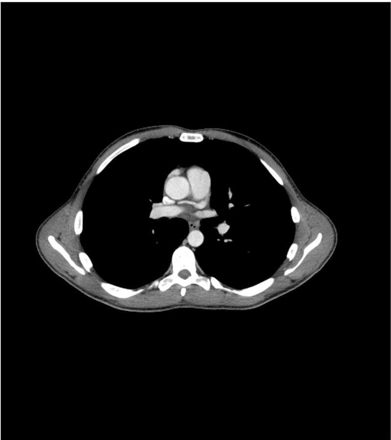 Anatomy Phantom Models for CT,  X-Ray, and Radiation Therapy