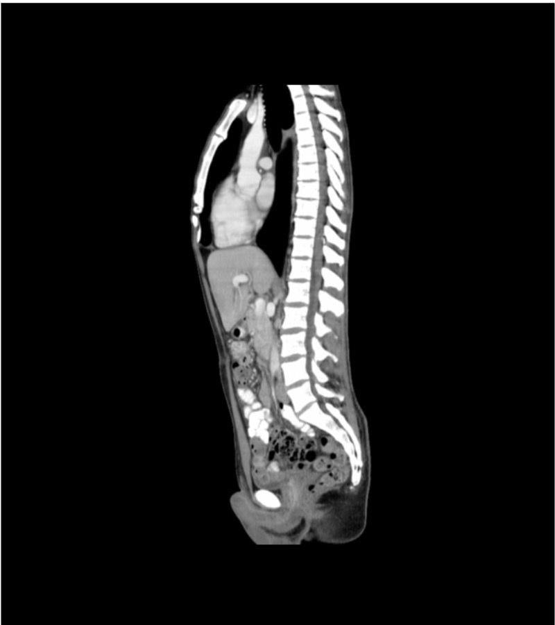 Anatomy Phantom Models for CT,  X-Ray, and Radiation Therapy