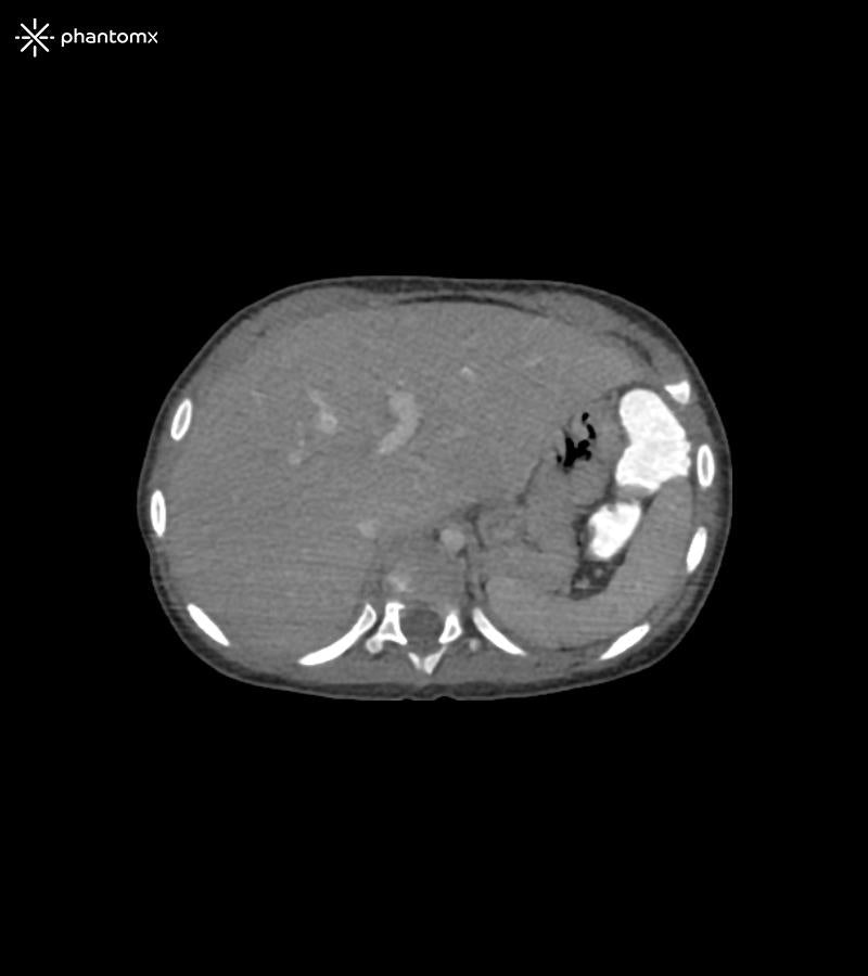 Anatomy Phantom Models for CT,  X-Ray, and Radiation Therapy