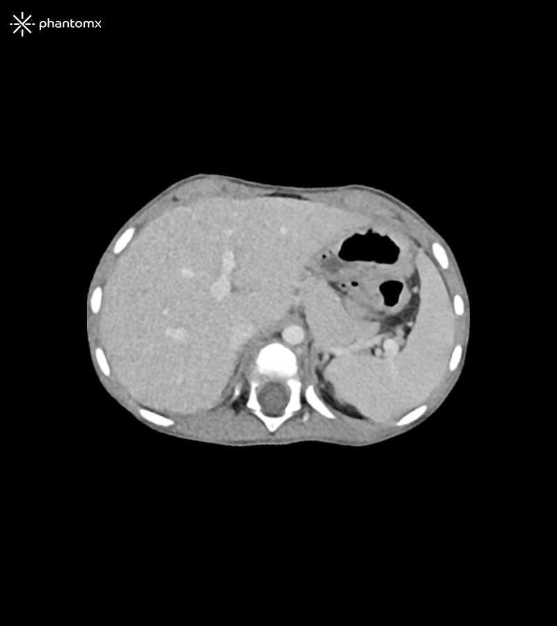 Anatomy Phantom Models for CT,  X-Ray, and Radiation Therapy