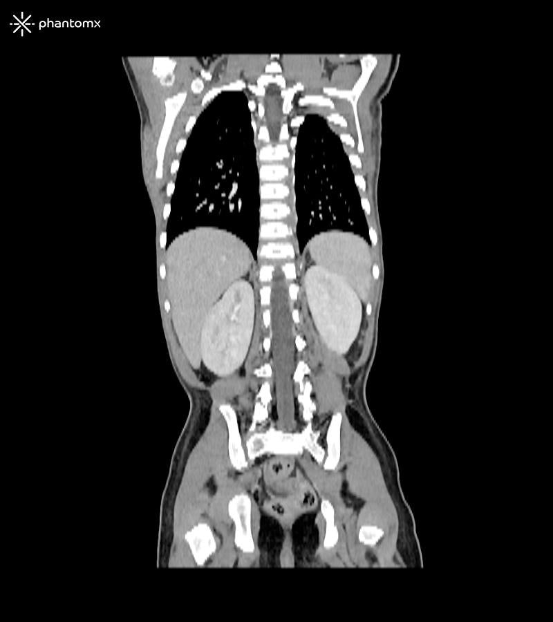 Anatomy Phantom Models for CT,  X-Ray, and Radiation Therapy
