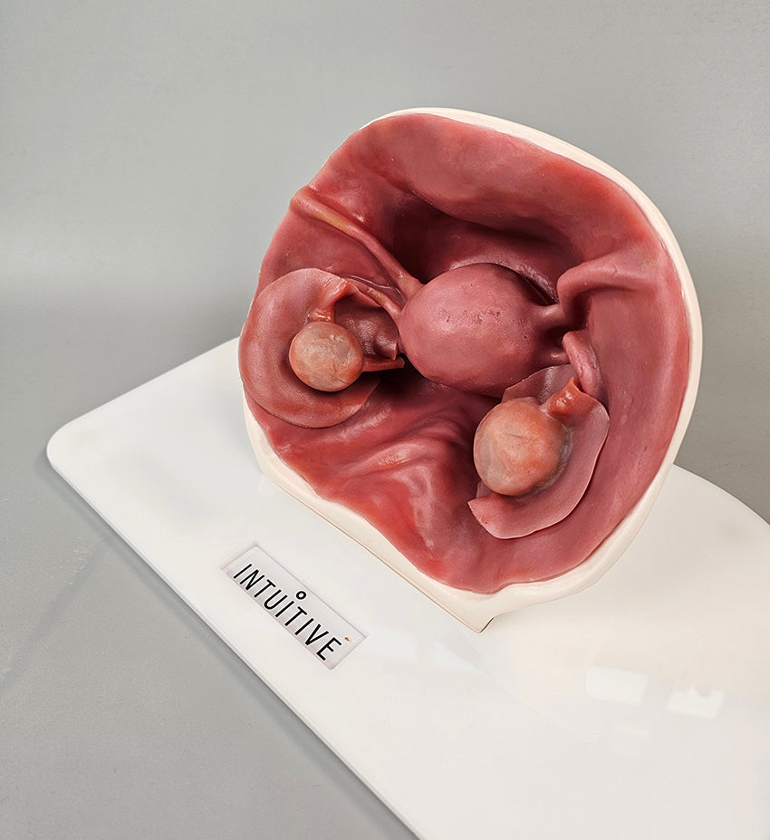 Ovarian Cystectomy Trainer