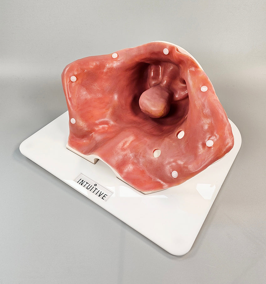 Sacrocolpopexy Trainer P-SCP-01 Image 1