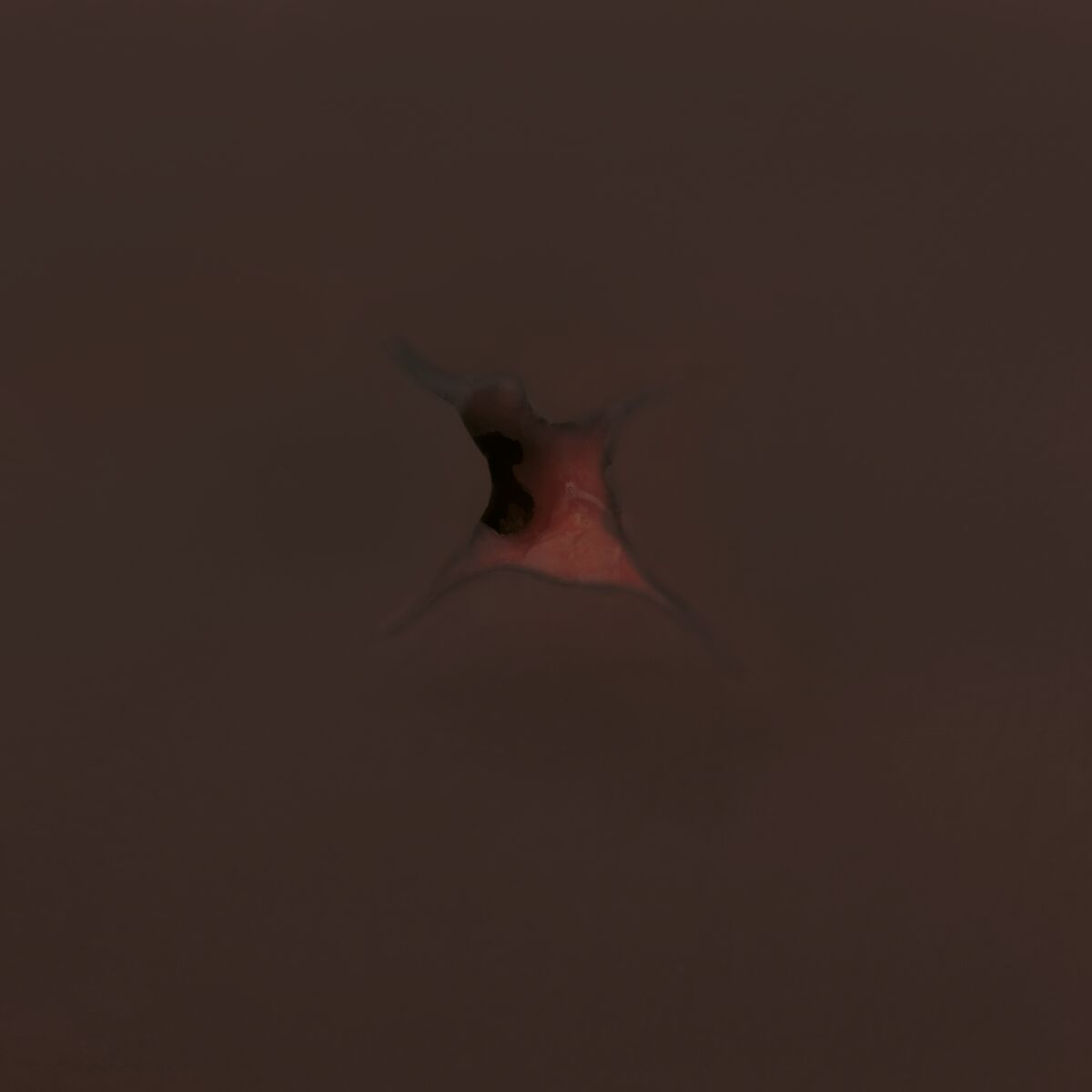 Haemorrhage Control Arm Trainer Dark Skin 1023313 wound detail