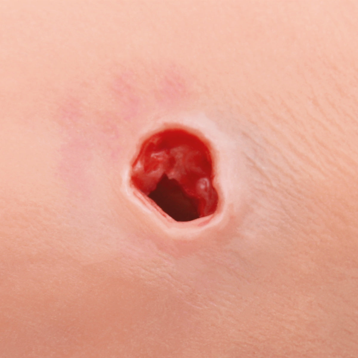 Haemorrhage Control Arm Trainer Light Skin 1022652 wound detail