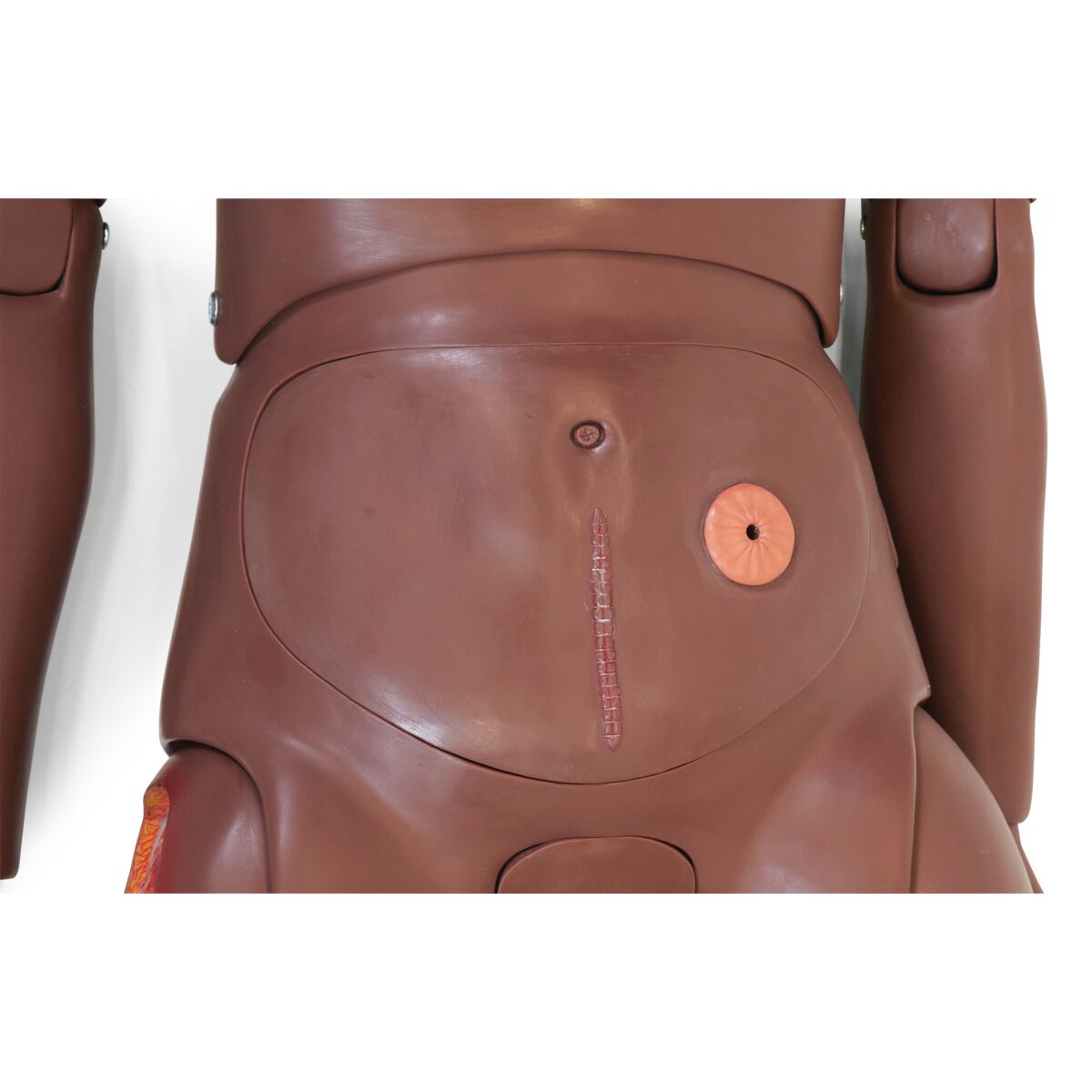 3B Scientific Patient Care Manikin Basic P11/1D 1023317 stoma suture lower abdominal