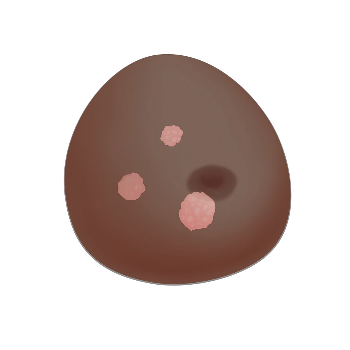 SONOtrain Ultrasound Breast Model with Tumours 1024723 masses