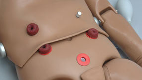 External Stoma Sites Option for MIKE and MICHELLE One-Year-Old Paediatric Care Simulator