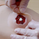 Switch Applying Pressure Injury Simulation Wound to manikin 2 image