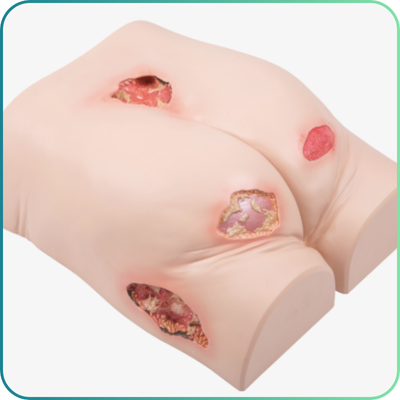 Pressure Ulcer Care