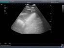 Switch Thoracentesis Ultrasound Training Model Clinical Ultrasound Image 3 image