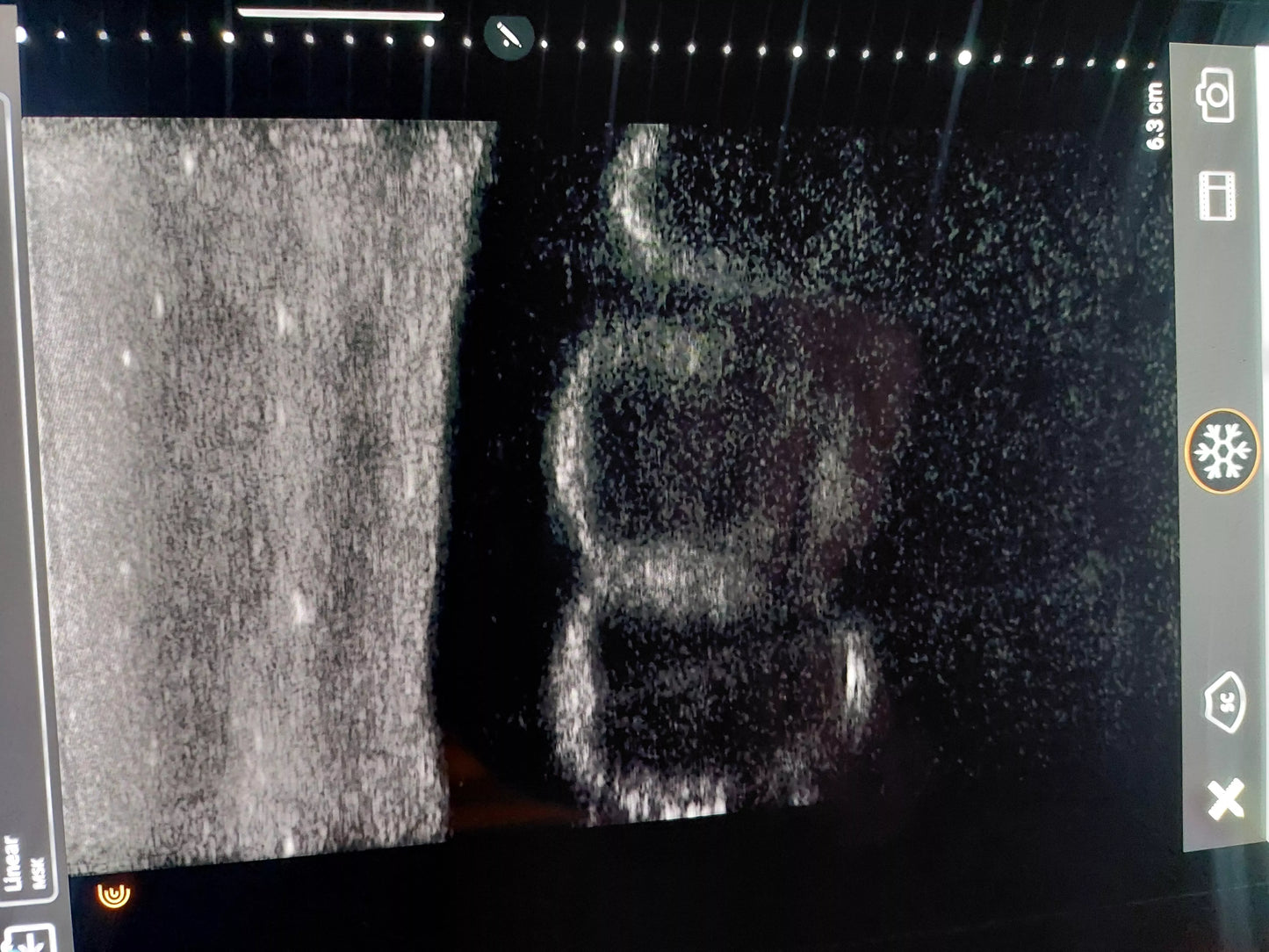 SonoEZ ultrasound trainer "Dog kidney" SEZ-KD Image 6