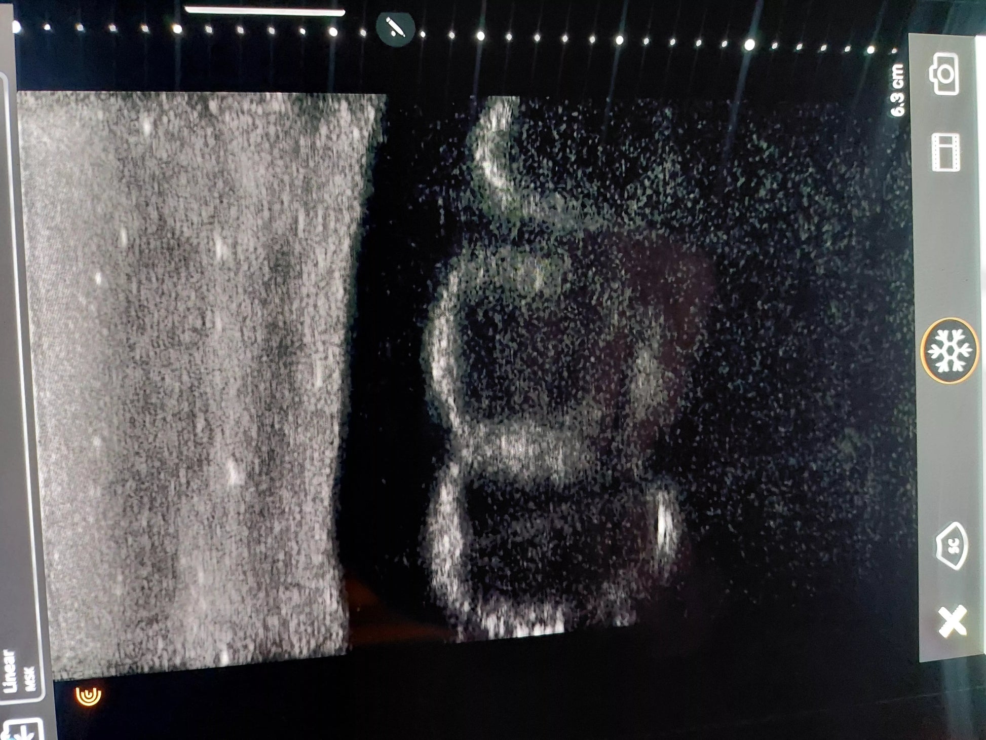 SonoEZ Ultrasound Trainer - Canine Kidney