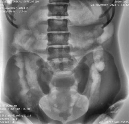 Adult Full Body Phantom for X-Ray CT, MRI