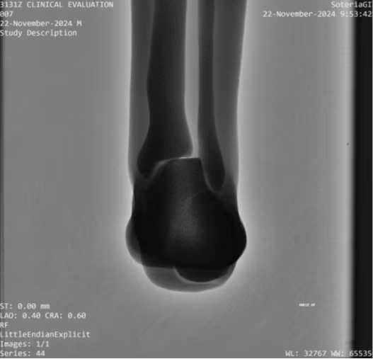 Adult Full Body Phantom for X-Ray CT, MRI
