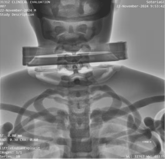 Adult Full Body Phantom for X-Ray CT, MRI