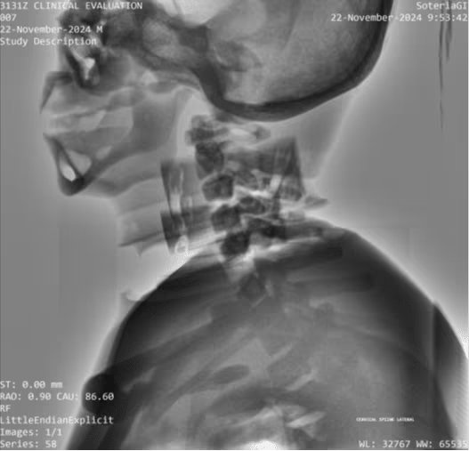 Adult Full Body for X-Ray CT, MRI FB-A01 image 14