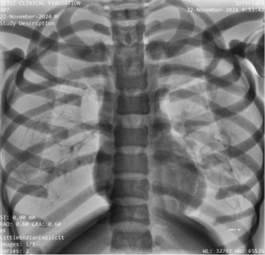 Adult Full Body Phantom for X-Ray CT, MRI