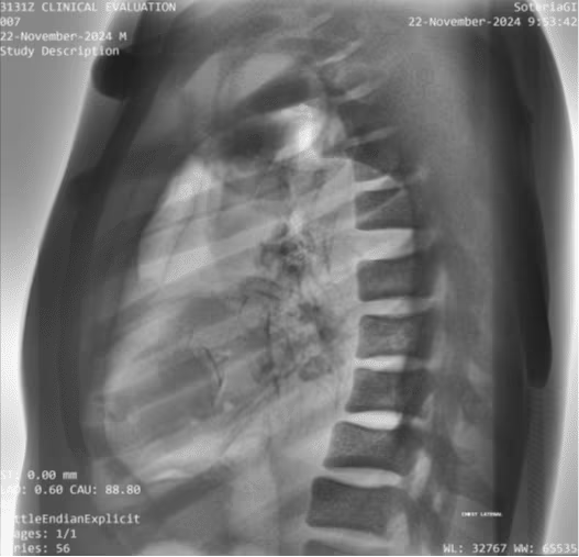 Adult Full Body Phantom for X-Ray CT, MRI
