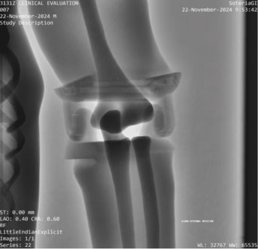 Adult Full Body Phantom for X-Ray CT, MRI