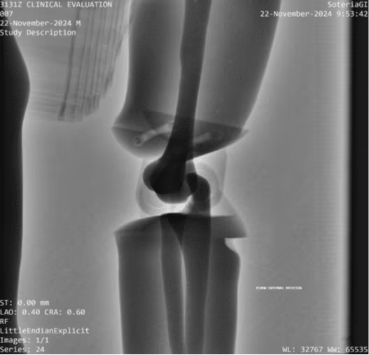 Adult Full Body Phantom for X-Ray CT, MRI