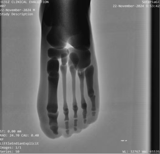 Adult Full Body Phantom for X-Ray CT, MRI