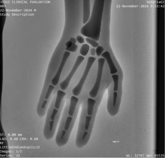Adult Full Body Phantom for X-Ray CT, MRI