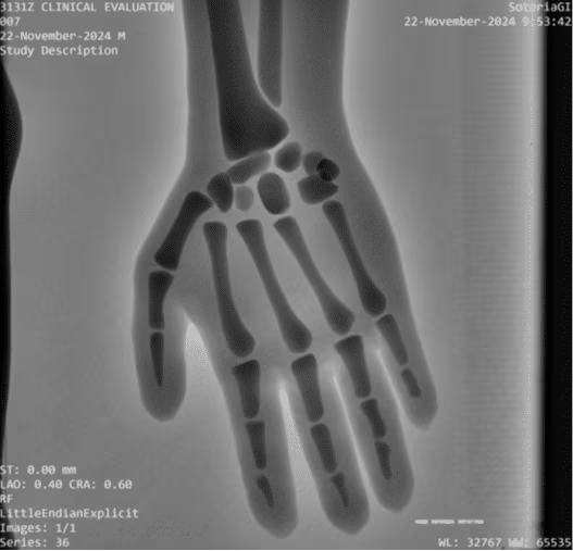 Adult Full Body Phantom for X-Ray CT, MRI