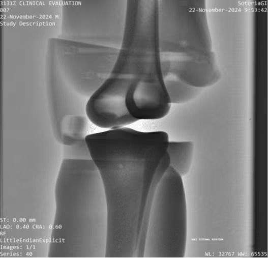 Adult Full Body Phantom for X-Ray CT, MRI