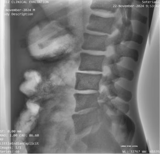 Adult Full Body Phantom for X-Ray CT, MRI