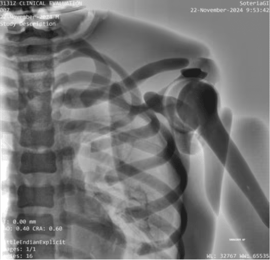 Adult Full Body for X-Ray CT, MRI FB-A01 image 26