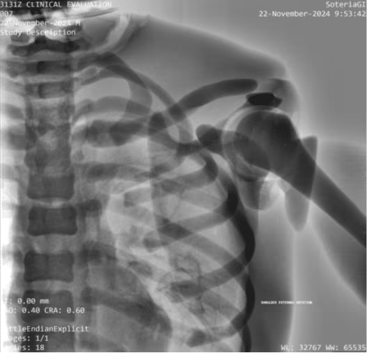 Adult Full Body for X-Ray CT, MRI FB-A01 image 27