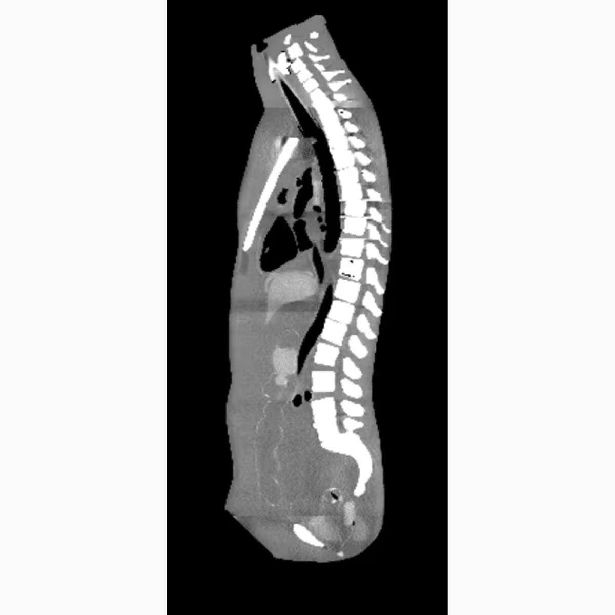 Adult Torso (Dynamic) for X-Ray CT, MRI TO-A05 image 12