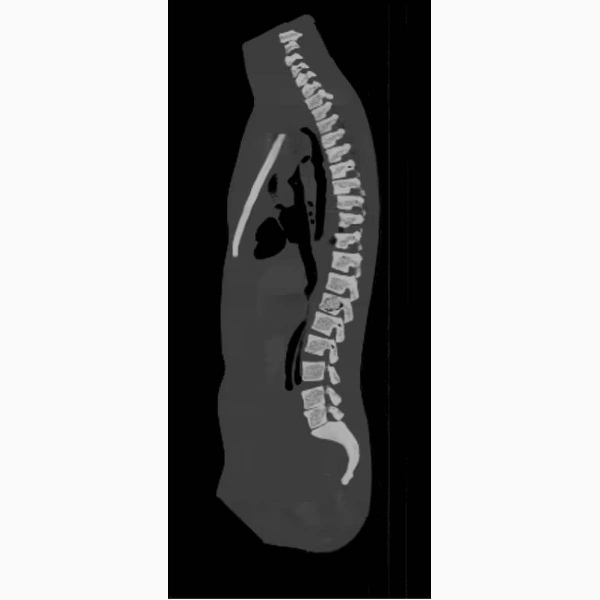 Adult Torso Phantom (Dynamic) for X-Ray CT, MRI
