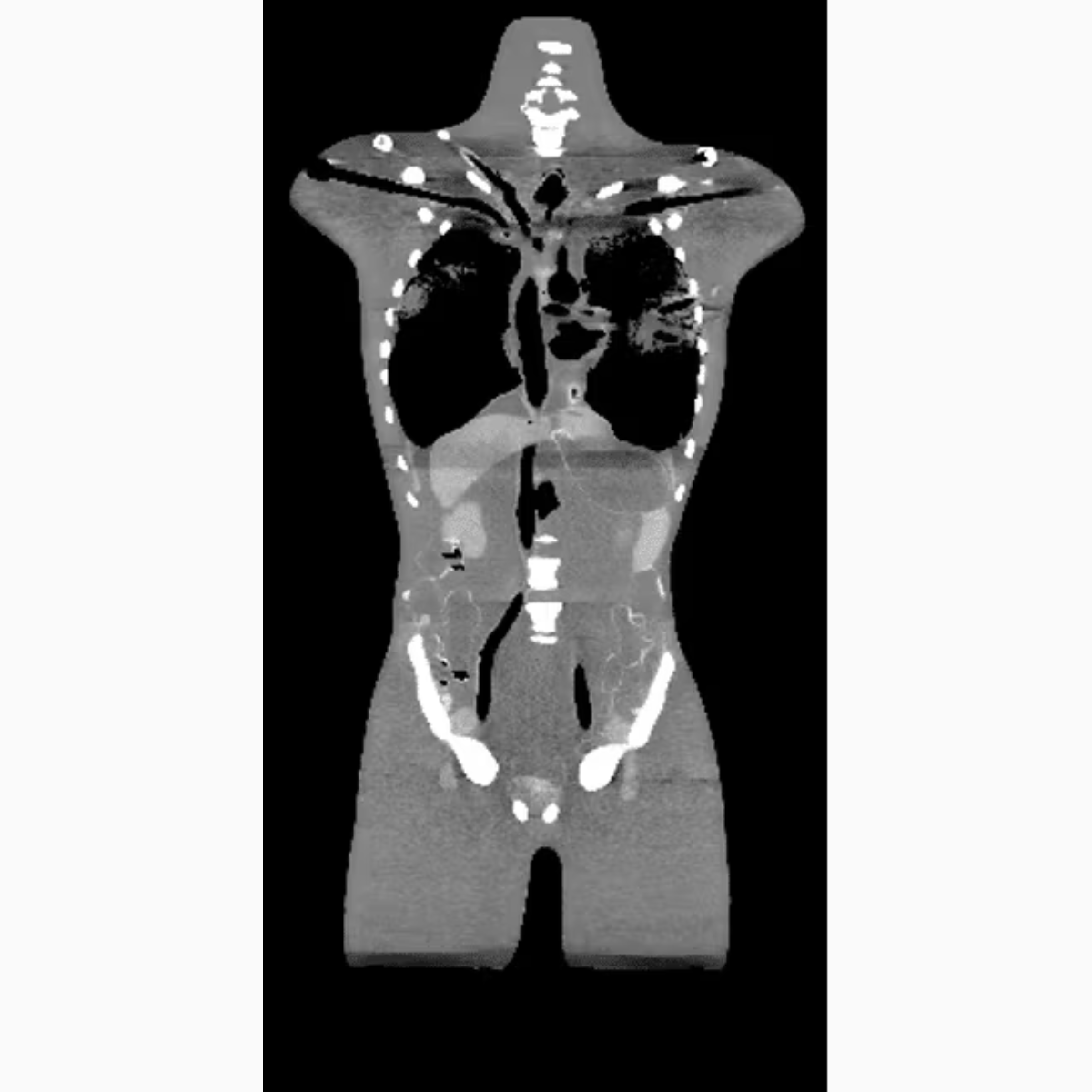 Adult Torso (Dynamic) for X-Ray CT, MRI TO-A05 image 14