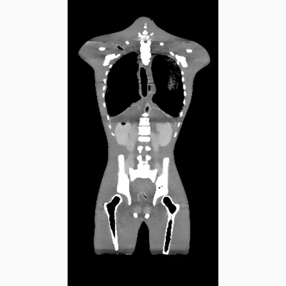 Adult Torso (Dynamic) for X-Ray CT, MRI TO-A05 image 15