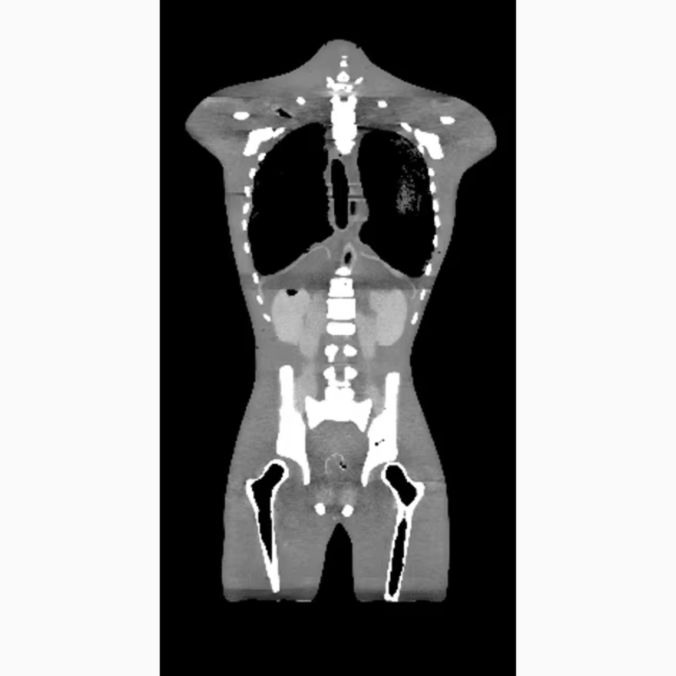 Adult Torso Phantom (Dynamic) for X-Ray CT, MRI